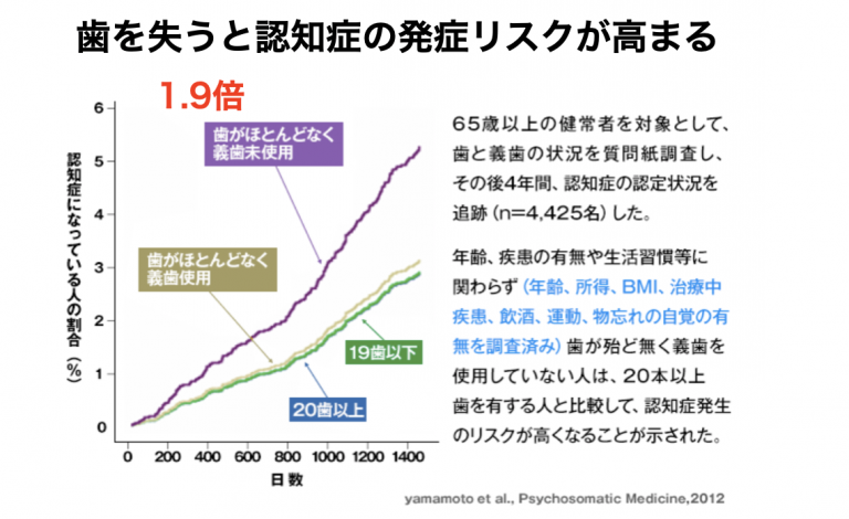 「かみ合わせ」の重要性