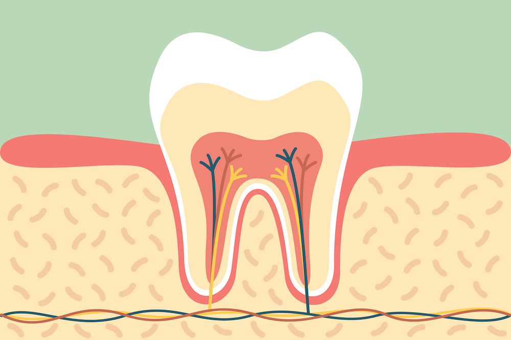 歯の神経を抜くってどういうこと？治療の仕組みを解説