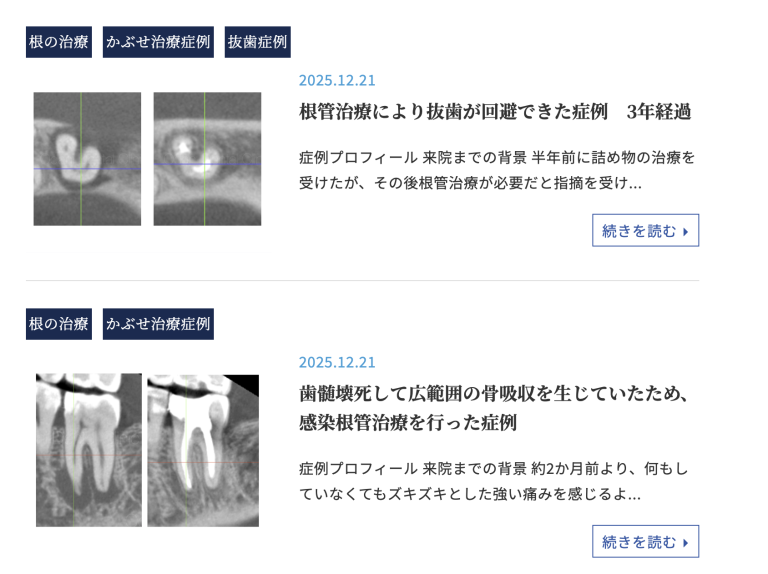 根の治療（根管治療）の診療ブログカテゴリー追加